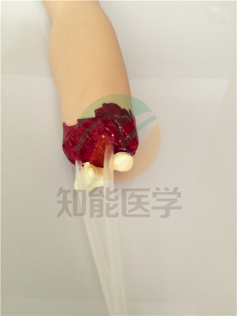 创伤护理模型