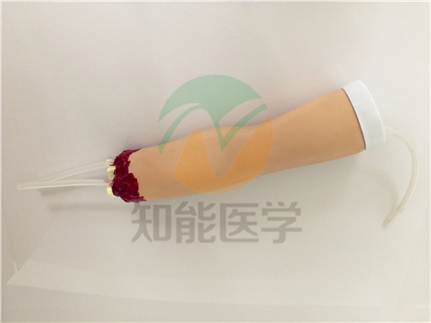创伤护理模型